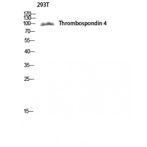 THBS4 / Thrombospondin 4 Antibody (530-610 aa, Internal)