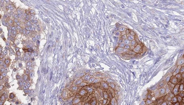 FCGR3A / CD16A Antibody