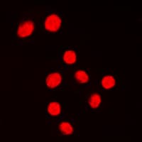 Polyclonal Rabbit anti-Human KLF1 + KLF5 + KLF7 Antibody (C-Terminus, IF, WB)