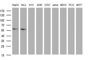ACD / PTOP Antibody (clone OTI2B1)
