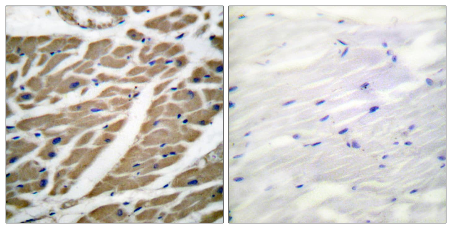 Sodium Channel Antibody (aa1466-1515)