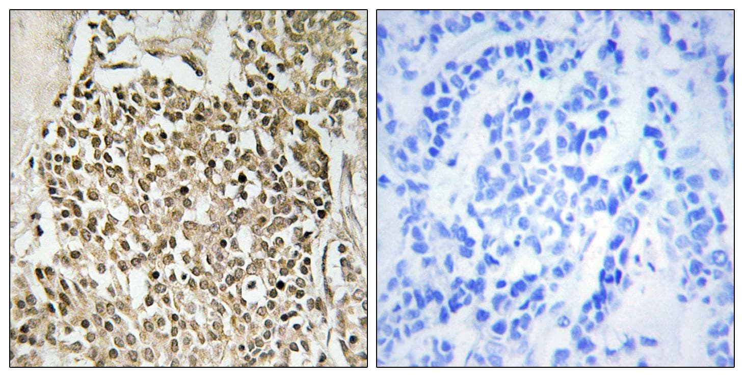 CEP350 / CAP350 Antibody