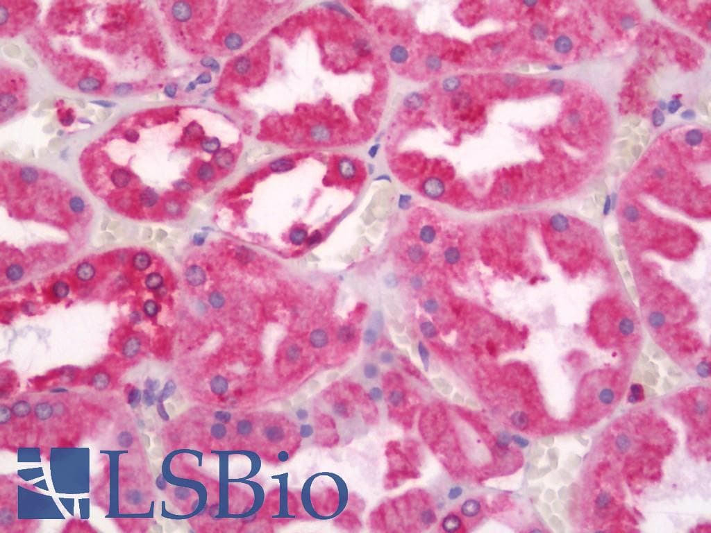 PathPlus™ CANX / Calnexin Antibody (C-Terminus)
