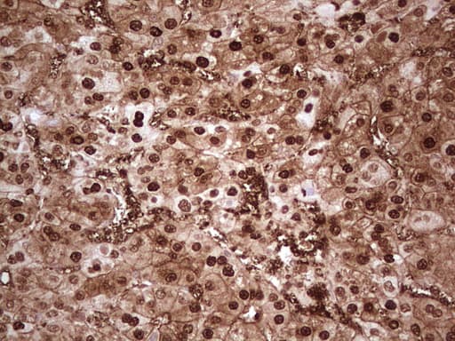 Monoclonal Mouse anti-Human MTOR Antibody (clone OTI4A6, aa1766-2144, IHC, WB)