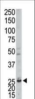 AK4 / Adenylate Kinase 4 Antibody (aa195-223)