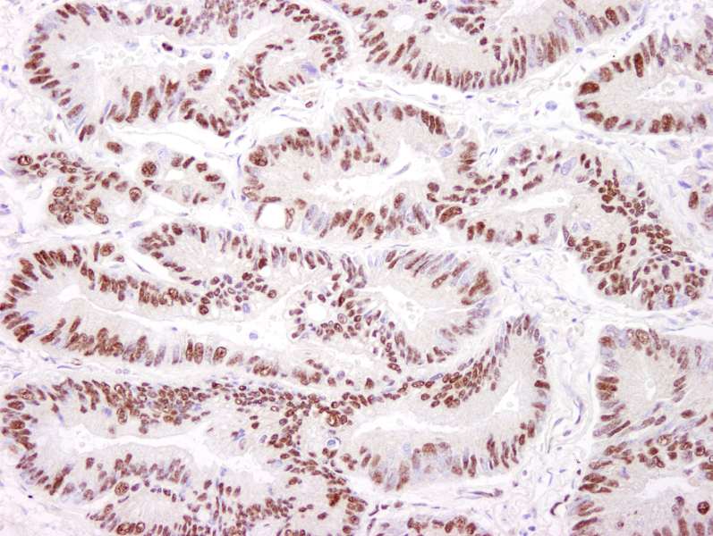 Polyclonal Rabbit anti-Human PRKDC / DNA-PKcs Antibody (aa2100-2150, IHC, WB)