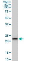 Monoclonal Mouse anti-Human RPS5 / Ribosomal Protein S5 Antibody (clone 3G3, WB)