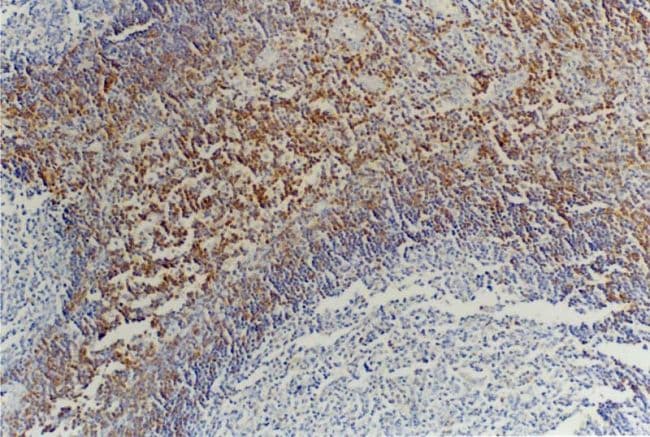 CD45RB Antibody (clone MEM-55)