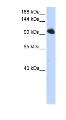 Polyclonal Rabbit anti-Human SFSWAP / SWAP Antibody (aa36-85, WB)