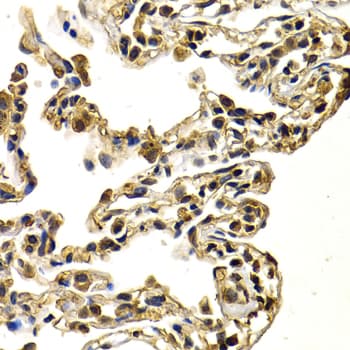 Polyclonal Rabbit anti-Human SNAI2 / SLUG Antibody (IHC, IF, WB)