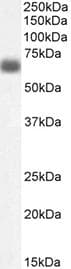 NTN1 / Netrin 1 Antibody