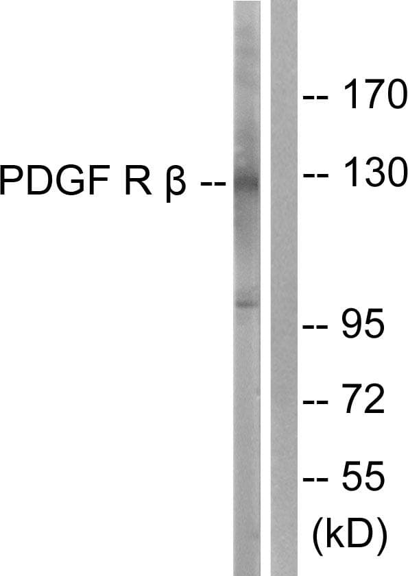 Polyclonal Rabbit anti-Human PDGFRB / PDGFR Beta Antibody (p740, WB)