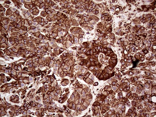 IQGAP1 Antibody (aa464-609, clone OTI6E1)
