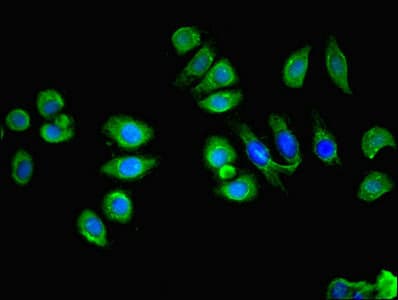 Polyclonal Rabbit anti-Human SCA2 / LY6E Antibody (aa21-101, IHC, IF)