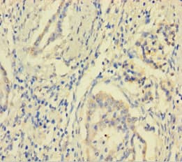 Polyclonal Rabbit anti-Human MCTS1 Antibody (aa1-181)