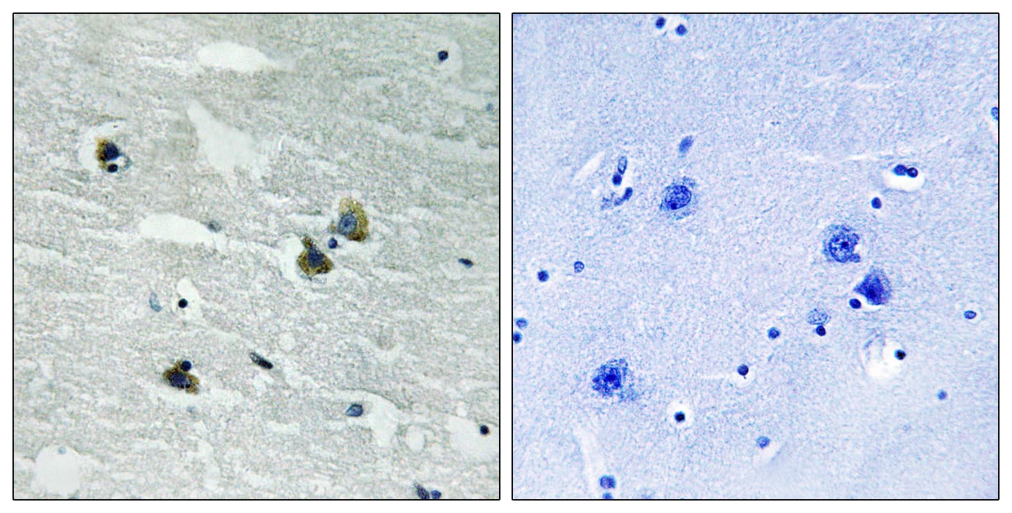 MER / MERTK Antibody (phospho-Tyr749/Tyr681)