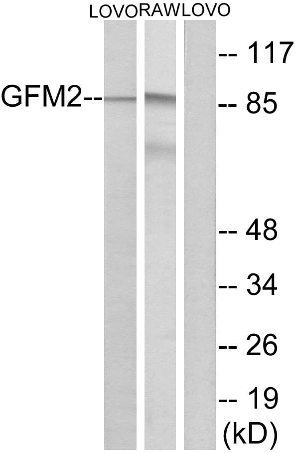 GFM2 Antibody (aa441-490)