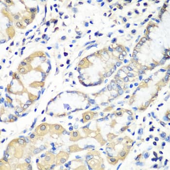 EZR / Ezrin Antibody