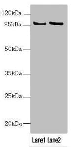 MAPK8IP2 / JIP2 Antibody