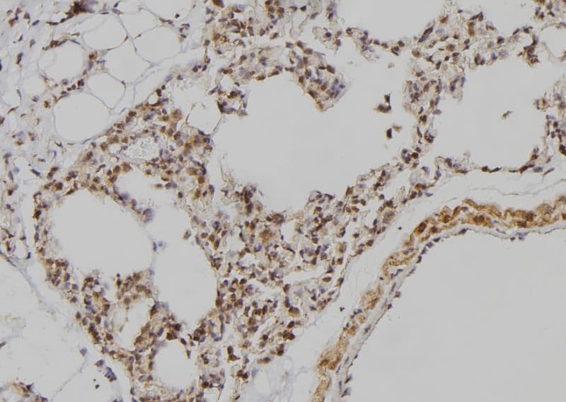 POU3F3 / BRN1 Antibody