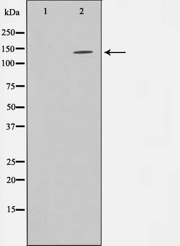 INPP5D / SHIP1 / SHIP Antibody