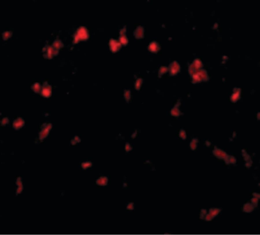 IHC-plus™ Polyclonal Rabbit anti-Human SPRED1 Antibody (IHC, IF, WB)
