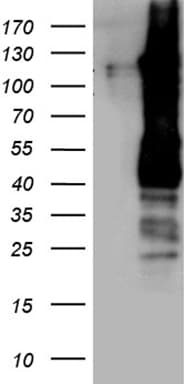 PPP6R2 / SAPS2 Antibody