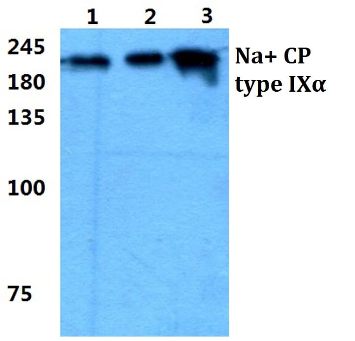 IHC-plus™ SCN9A / Nav1.7 Antibody (aa702-747)