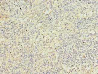 Polyclonal Rabbit anti-Human UBASH3B / STS-1 Antibody (IHC)