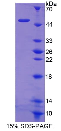 Rat HK1 / Hexokinase 1 Protein (Recombinant His-GST-S)