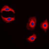 MMP3 Antibody (C-Terminus)