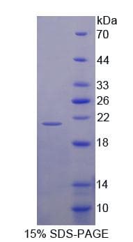 Human UXT Protein (Recombinant His-T7)