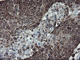 SKIL / SNO / SnoN Antibody (clone OTI3F6)