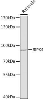 RIP4 / ANKRD3 Antibody