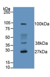 HFE2 / Hemojuvelin Antibody (aa234-416)