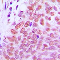 Polyclonal Rabbit anti-Human RXRG Antibody (Internal, IHC, IF, WB)