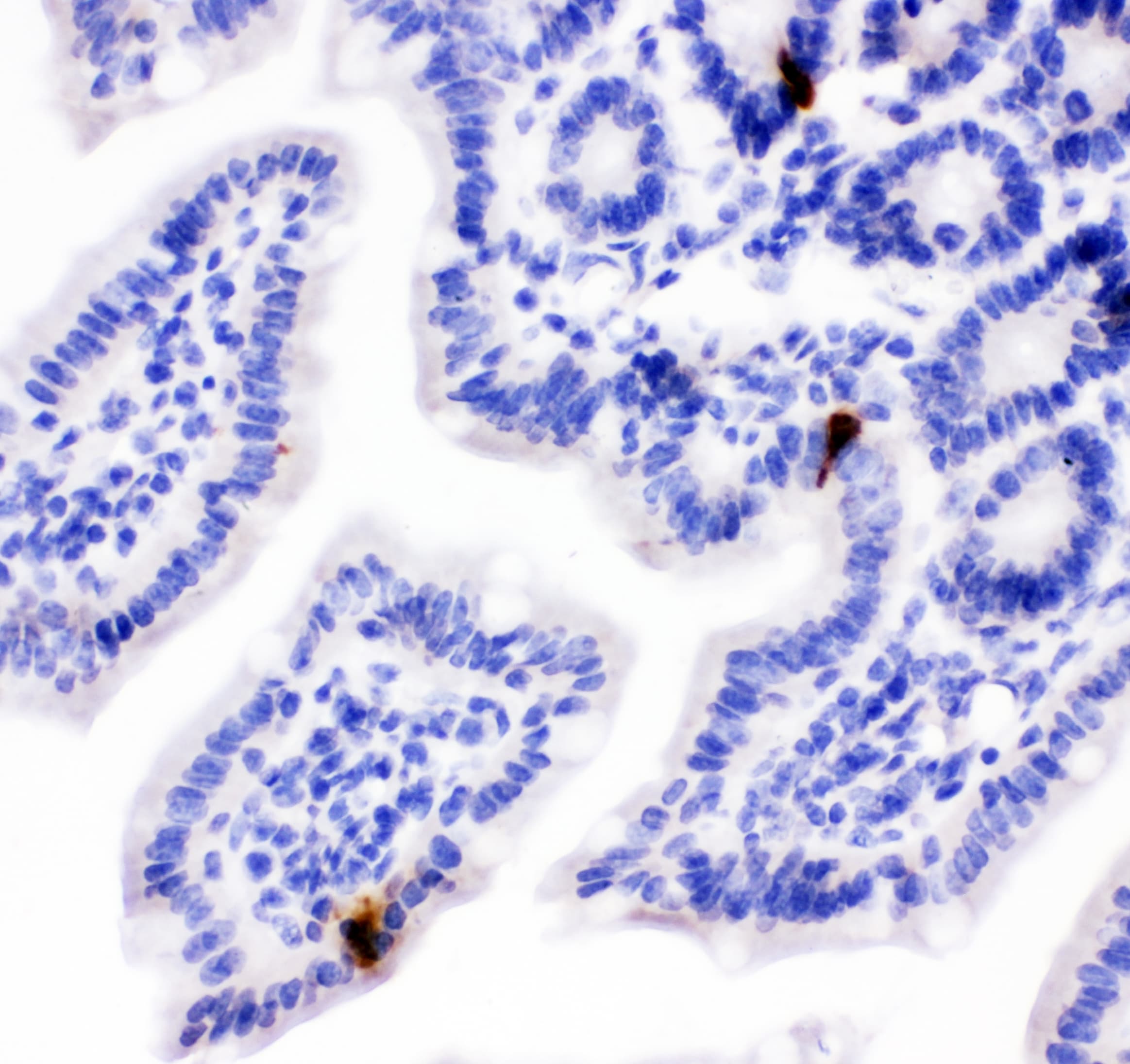 Peptide YY / PYY Antibody