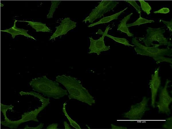 Monoclonal Mouse anti-Human PLS3 / T Plastin Antibody (clone 5B9, IF, WB)