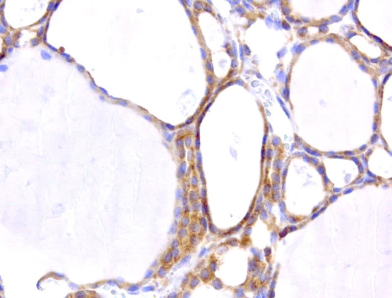 Monoclonal Mouse anti-Human WIBG Antibody (clone UMAB209, IHC, IF, WB)