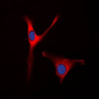 OAT Antibody (Internal)