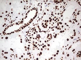 Monoclonal Mouse anti-Human HNRPM / HNRNPM Antibody (clone OTI3F3, aa1-261, IHC, WB)