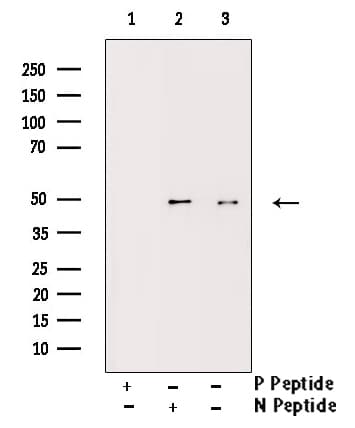 IKBKG / NEMO / IKK Gamma Antibody (phospho-Ser31)