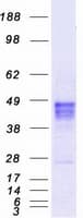 Human RAD9A / RAD9 Protein (Recombinant Myc-DDK (Flag))