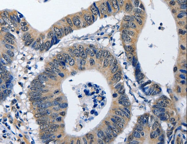 Polyclonal Rabbit anti-Human NFKBID / IkappaBNS Antibody (IHC, WB)