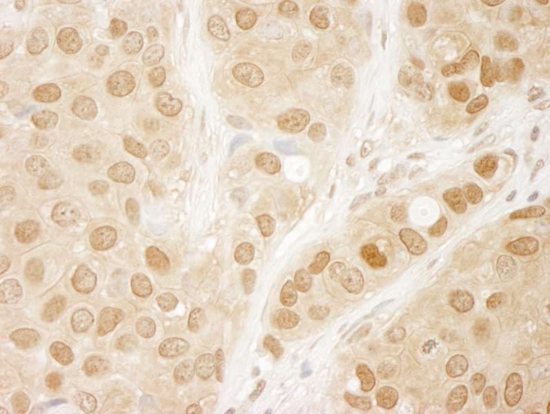 AKT1 Antibody (aa25-75)