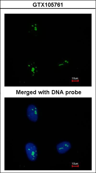 IHC-plus™ KRR1 Antibody (aa47-344)