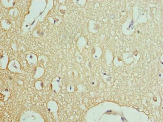 RPH3A / Rabphilin 3A Antibody