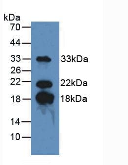 MBP / Myelin Basic Protein Antibody (aa135-190)