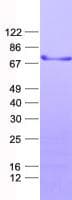 Human ZNF851 / ZBTB44 Protein (Recombinant His, N-Terminal)