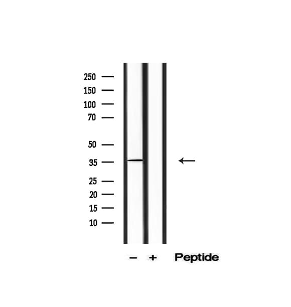 NFKBIB / IKB Beta / IKBB Antibody